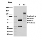 SDS-PAGE analysis of purified, BSA-free recombinant Glycoprotein 2/GP2 antibody (clone GP2/3134R) as confirmation of integrity and purity.