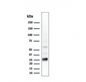Western blot testing of human liver lysate with GSTM2 antibody (clone CPTC-GSTMu2-2). 