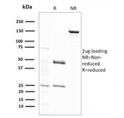 SDS-PAGE analysis of purified, BSA-free GSTM2 antibody (clone CPTC-GSTMu2-2) as confirmation of integrity and purity.