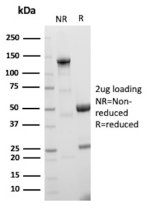 Purified DC-SIGN Antibody C209/2749R SDS-PAGE. Electrophoretic analysis of 2.5 ug of purified, BSA-free recombinant clone C209/2749R under non-reducing (NR) and reducing (R) conditions. The non-reduced sample shows predominantly intact antibody at approximately 100 kDa under the conditions shown, while reduction produces the expected immunoglobulin heavy and light chain bands at approximately 50 and 25 kDa, respectively, demonstrating the integrity and purity of the antibody preparation.