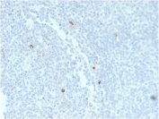 IHC staining of FFPE human tonsil tissue with recombinant IgM Heavy Chain antibody (clone rIM373). HIER: boil tissue sections in pH6, 10mM citrate buffer, for 10-20 min and allow to cool before testing.