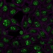 Ki-67 Antibody for IF (clone MKI67/2466) immunofluorescence staining of human HeLa cells. Human HeLa cells were stained with Ki-67 Antibody for IF (clone MKI67/2466). Green fluorescence highlights nuclear Ki-67 / MKI67 expression in proliferating cells, showing the characteristic punctate nuclear staining pattern associated with this cell cycleâregulated proliferation marker. Cell boundaries and actin-rich structures are visualized with Phalloidin (red-purple), allowing clear visualization of cellular morphology and confirming nuclear localization of the Ki-67 signal in actively cycling cells.