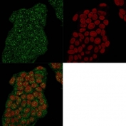 Mammaglobin Antibody for IF immunofluorescence staining of human MCF7 cells. Permeabilized human MCF7 breast carcinoma cells were stained with Mammaglobin Antibody for IF (clone MGB/2682R). Green fluorescence highlights Mammaglobin A / SCGB2A2 expression within the cytoplasm of tumor epithelial cells, consistent with the localization of this secreted breast-associated protein. Nuclei are counterstained with Reddot nuclear stain (red), allowing visualization of cell morphology and confirming cytoplasmic distribution of the Mammaglobin signal in breast cancer cells.