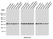 MTAP Antibody Cross-Species WB. Western blot analysis of MTAP expression across brain, kidney, and ovary tissues from multiple species using MTAP antibody clone MTAP/3137R. A consistent band at approximately 30-35 kDa is observed, supporting conserved expression across species.