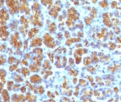 Immunohistochemistry of CELA3B Antibody Recombinant Rabbit MAb ELTS3B-4R in human pancreas. Formalin-fixed, paraffin-embedded human pancreatic tissue demonstrates strong granular cytoplasmic staining in acinar cells, consistent with the secretory localization of Chymotrypsin-like elastase family member 3B, while surrounding stromal elements are largely negative. Required HIER: boil tissue sections in 10mM Tris with 1mM EDTA, pH 9, for 10-20 min followed by cooling at RT for 20 min.