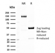 SDS-PAGE analysis of purified, BSA-free recombinant GLUT1 antibody GLUT1/3132R as confirmation of integrity and purity.