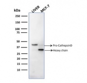 Cathepsin D Antibody Liver and MCF7 WB. Western blot testing of human samples with Cathepsin D antibody (clone CTSD/2781).