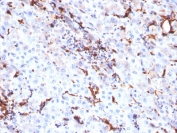 Cathepsin K Lysosomal Protease Antibody Liver Tissue IHC. Immunohistochemistry analysis of FFPE human liver tissue using Cathepsin K Antibody (clone CTSK/2791) shows focal granular cytoplasmic staining in scattered cells, consistent with CTSK / Cathepsin K localization in lysosomal compartments. The punctate staining pattern reflects lysosomal protease distribution associated with tissue remodeling activity, while hepatocytes show comparatively low background staining. Hematoxylin counterstain provides nuclear contrast and structural context. HIER: boil FFPE tissue sections in pH 6, 10 mM citrate buffer, for 10-20 min followed by cooling at RT for 20 min.