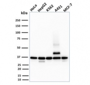 RAD51 Antibody Human Cell Lines WB. Western blot analysis of RAD51 expression using a RAD51 antibody. Lane 1: human HeLa cell lysate. Lane 2: human HepG2 cell lysate. Lane 3: human K562 cell lysate. Lane 4: human A431 cell lysate. Lane 5: human MCF-7 cell lysate. RAD51, also known as a Homologous Recombination Protein, is a key mediator of DNA double strand break repair and genome stability. A prominent band is detected at approximately 37 kDa in all cell lines, consistent with the predicted molecular weight of RAD51. Additional lower molecular weight bands are observed in some lysates and may represent degradation products or alternatively processed forms, while a higher molecular weight species is evident in A431 cells and may reflect post translationally modified or multimeric forms of RAD51. These results support the utility of RAD51 Antibody for studies of homologous recombination, DNA damage responses, and cancer biology.