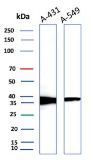 RAD51 Antibody A431 and A549 WB. Western blot analysis of RAD51 expression using RAD51 antibody (clone RAD51/2701). Lane 1: human A431 cell lysate. Lane 2: human A549 cell lysate. RAD51, also known as RAD51 Recombinase, is a central mediator of homologous recombination and DNA double strand break repair that preserves genomic stability. A prominent band is detected at approximately 37 kDa in both cell lines, consistent with the expected molecular weight of RAD51. These results demonstrate endogenous expression of RAD51 in epithelial cancer cells and support the utility of this antibody for studies of DNA repair pathways, genome maintenance, and cellular responses to genotoxic stress.