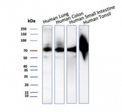 CD44 Antibody Human Tissue Glycoprotein WB. Western blot analysis of CD44 / CD44 antigen expression in human lung, colon, small intestine, and tonsil lysates using recombinant rabbit monoclonal antibody clone HCAM/2875R. Bands are observed across a range of approximately 75-110 kDa, consistent with glycosylation-dependent variation in CD44 molecular weight across different tissue types.