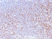 Recombinant Nuclear Marker Antibody Tonsil IHC. Immunohistochemistry staining of FFPE human tonsil tissue using Nuclear Marker Antibody (clone NM2984R) demonstrates distinct nuclear HRP-DAB brown staining throughout lymphoid cell populations. The staining pattern is consistent with recognition of a nuclear-associated antigen and provides clear visualization of cellular nuclei within the densely packed tonsillar architecture. Strong nuclear localization highlights individual lymphocytes and other resident immune cells while maintaining low background staining in non-nuclear compartments. The observed immunoreactivity supports the use of clone NM2984R for nuclear visualization, assessment of tissue organization, and studies requiring identification of cellular nuclei in normal and pathological specimens. HIER: boil tissue sections in pH 6 citrate buffer (10 mM) for 10-20 minutes and allow to cool prior to testing.