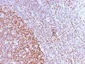 Recombinant Nuclear Marker Antibody Tonsil Germinal Center IHC. Immunohistochemistry staining of FFPE human tonsil tissue using Nuclear Marker Antibody (clone NM2984R) demonstrates strong nuclear HRP-DAB brown staining throughout lymphoid cell populations, with particularly intense labeling within germinal center-associated regions. The staining pattern is consistent with recognition of a nuclear-associated antigen and provides excellent visualization of nuclear morphology and cellular distribution within the tonsillar microenvironment. Distinct nuclear localization highlights densely packed lymphocytes while maintaining minimal staining of cytoplasmic and extracellular compartments. The observed immunoreactivity supports the use of clone NM2984R for nuclear visualization, tissue architecture assessment, and identification of cellular nuclei in lymphoid tissues and other histological specimens. HIER: boil tissue sections in pH 6 citrate buffer (10 mM) for 10-20 minutes and allow to cool prior to testing.
