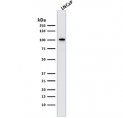 FOLH1 Antibody LNCaP WB. Western blot analysis of human LNCaP cell lysate using FOLH1 Antibody / Prostate Cancer and PSMA Marker. A strong band is detected at approximately 100 kDa, consistent with the predicted molecular weight of Folate hydrolase 1 / FOLH1, also known as Prostate-specific membrane antigen / PSMA. The observed signal is consistent with established FOLH1 expression in prostate-derived tumor cell models and supports its role as a membrane-associated enzyme involved in prostate cancer-associated signaling and folate metabolism pathways.