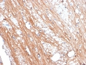 FOLH1 Antibody Cow Brain IHC. Immunohistochemistry analysis of FFPE cow brain tissue stained with FOLH1 Antibody / Prostate Cancer and PSMA Marker. Neural tissue demonstrates diffuse cytoplasmic and fibrillar HRP-DAB brown staining consistent with expression of Folate hydrolase 1 / FOLH1, also known as Prostate-specific membrane antigen / PSMA, a glutamate carboxypeptidase involved in neuropeptide metabolism and glutamatergic signaling pathways within the nervous system. Required HIER: boil tissue sections in pH 9 10mM Tris with 1mM EDTA for 10-20 min and allow to cool before testing.