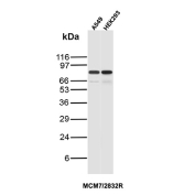 MCM7 Antibody Cell Line WB. Western blot analysis of MCM7 / Minichromosome maintenance protein 7 expression in A549 and HEK293 cell lysates using MCM7 antibody clone MCM7/2832R. Lane 1: A549 lysate, Lane 2: HEK293 lysate. A band is detected at approximately 75-80 kDa, consistent with the predicted molecular weight of MCM7.