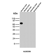 Albumin Antibody Liver Species Comparison WB. Western blot analysis of human, mouse, rat, hamster, and guinea pig liver tissue lysates using Albumin antibody detects a prominent band at approximately 65-70 kDa in human liver, consistent with the predicted molecular weight of Albumin (ALB), with minimal signal observed in other species under these conditions; detection was performed with clone ALB/2356.
