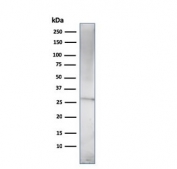 Western blot testing of human U937 cell lysate with Prolactin antibody (clone (PRL/2910). Predicted molecular weight: ~25 kDa.