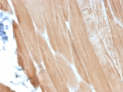 IHC staining of FFPE human skeletal muscle tissue with Sarcomeric Alpha Actinin antibody (clone ACTN2/3293). HIER: boil tissue sections in pH 9 10mM Tris with 1mM EDTA for 10-20 min and allow to cool before testing.
