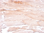 Dystrophin Antibody Skeletal Muscle Fiber IHC. Immunohistochemistry analysis of FFPE skeletal muscle tissue using Dystrophin Antibody (clone DMD/3241) shows reduced and discontinuous membranous staining along individual muscle fibers, consistent with altered dystrophin localization at the sarcolemma. The fragmented staining pattern contrasts with the continuous membrane outline typically observed in normal muscle, supporting detection of dystrophin in a context of compromised muscle fiber integrity. Hematoxylin counterstain provides nuclear contrast and tissue architecture. HIER: boil FFPE tissue sections in pH 6 10 mM citrate buffer for 10-20 min and allow to cool before testing.