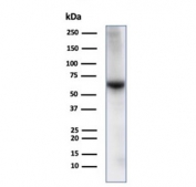 Albumin Antibody Human Liver WB. Western blot analysis of human liver tissue lysate using Albumin antibody detects a strong band at approximately 65-70 kDa, consistent with the predicted molecular weight of Albumin (ALB), a major liver-derived serum protein and marker of hepatocyte function; detection was performed with clone ALB/2141.