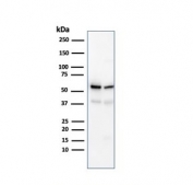 SERBP1 Antibody WB. Western blot analysis of human K562 and PC-3 cell lysates using SERBP1 Antibody detects bands migrating between approximately 45-60 kDa, consistent with the predicted molecular weight of SERBP1 and known variability in migration associated with post-translational modification and RNA-binding protein-associated electrophoretic behavior. This mRNA binding protein antibody highlights expression of SERBP1-associated post-transcriptional regulatory signaling pathways in hematologic and epithelial-derived tumor cell lines.