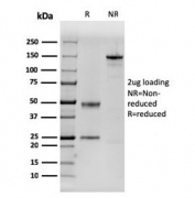 SDS-PAGE analysis of purified, BSA-free Dystrophin antibody (clone DMD/3243) as confirmation of integrity and purity.