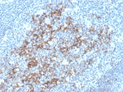 CD23 Antibody Tonsil IHC. Immunohistochemistry analysis of FFPE human tonsil tissue stained with CD23 antibody clone FCER2/3592. Distinct membranous and cytoplasmic HRP-DAB brown staining is observed in germinal center-associated B lymphocytes and follicular dendritic cell networks, consistent with the established expression pattern of Low-affinity immunoglobulin epsilon Fc receptor / FCER2/CD23 in reactive lymphoid follicles. The staining pattern highlights follicular architecture with strong positivity in B-cell-rich germinal center regions and comparatively minimal staining in surrounding interfollicular T-cell areas. Hematoxylin counterstain highlights nuclei in blue. HIER: boil tissue sections in pH6 citrate buffer for 10-20 min followed by cooling before antibody incubation.