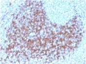 Immunohistochemistry of CD23 Antibody Biotin Conjugate in human tonsil. FFPE human tonsil tissue was stained with biotin-labeled CD23 antibody (clone FCER2/3592). Prominent membranous HRP-DAB brown staining is observed in B lymphocytes within germinal centers and mantle zone regions, consistent with established CD23 expression on mature follicular B cells. The staining pattern highlights follicular architecture, with dense labeling in B cell rich areas and minimal staining in adjacent T cell predominant interfollicular zones. Heat induced epitope retrieval was performed by boiling tissue sections in pH 9 Tris-EDTA buffer for 20 minutes followed by cooling prior to antibody incubation. The biotin conjugate format allows detection using streptavidin based amplification systems.