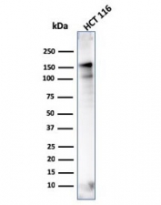 MSH6 antibody western blot testing of human HCT116 lysate with clone MSH6/3086. Expected molecular weight: 120-160 kDa depending on phosphorylation level.