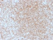 IHC staining of FFPE human spleen with CD137/4-1BB antibody (clone 4-1BB/3201). HIER: boil tissue sections in pH9 10mM Tris with 1mM EDTA for 10-20 min and allow to cool before testing.