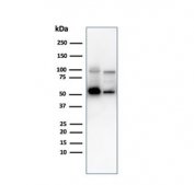 Western blot testing of human 1) K562 and 2) PC-3 cell lysate with SERBP1 antibody. Predicted molecular weight ~45 kDa but observed at 45-60 kDa.