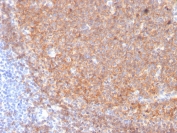 IHC staining of FFPE human tonsil with CD19 antibody (clone CD19/3117). HIER: boil tissue sections in pH 9 10mM Tris with 1mM EDTA for 10-20 min and allow to cool before testing.