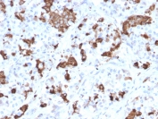 IHC testing of FFPE human pituitary tissue with Prolactin antibody (clone PRL/2644). Required HIER: boil tissue sections in pH 9 10mM Tris with 1mM EDTA for 10-20 min followed by cooling at RT for 20 min.