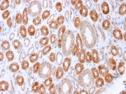 Immunohistochemistry of Occludin antibody in human kidney tissue. The microarray validated clone OCLN/2183 demonstrates strong membranous HRP-DAB brown staining along renal tubular epithelial cell borders, consistent with tight junction localization of Occludin. Staining highlights apical lateral cell-cell junctions forming continuous circumferential patterns within tubular structures, while surrounding interstitial tissue shows minimal background signal. Heat-induced epitope retrieval was performed by boiling tissue sections in pH 9 10mM Tris with 1mM EDTA for 10-20 minutes followed by cooling prior to incubation.