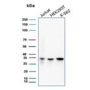Cdk2 Antibody Cell Line WB. Western blot analysis of Cyclin-dependent kinase 2 (Cdk2) expression in cell lysates using Cdk2 antibody clone AN21.2. Lane 1: Jurkat cell lysate, Lane 2: HEK293T cell lysate, Lane 3: K-562 cell lysate. A band is detected at approximately 33â34 kDa, consistent with the predicted molecular weight of Cdk2, a key regulator of cell cycle progression. The presence of signal across all three cell lines reflects the ubiquitous expression of Cdk2 in proliferating cells.