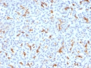 CFTR Antibody Pancreas IHC. Immunohistochemistry analysis of Cystic fibrosis transmembrane conductance regulator / CFTR expression in FFPE human pancreatic tissue using mouse monoclonal antibody clone CFTR/1342. HRP-DAB brown staining is observed with apical membranous and luminal accentuation in ductal epithelial cells, while surrounding acinar tissue shows minimal signal; nuclei are counterstained blue. This CFTR antibody complements mouse tissue findings by enabling comparison between human and mouse epithelial expression patterns. Antigen retrieval was performed by boiling sections in 10 mM Tris buffer with 1 mM EDTA, pH 9, for 10-20 min followed by cooling at room temperature.