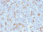 CFTR Antibody Clone M3A7 Pancreas Tissue IHC. Immunohistochemistry testing of FFPE human pancreas with CFTR antibody (clone M3A7). Staining of FFPE tissue is enhanced by boiling tissue sections in 10mM Tris with 1mM EDTA, pH9 for 10-20 min followed by cooling at RT for 20 min.