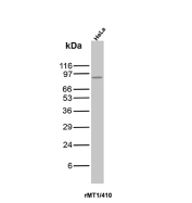 MALT1 Antibody for WB HeLa Lysate. Western blot analysis of Mucosa associated lymphoid tissue lymphoma translocation protein 1 / MALT1 expression in human HeLa cell lysate using recombinant mouse monoclonal antibody clone rMT1/410. This MALT1 Antibody for WB detects a distinct band at approximately the expected molecular weight for MALT1, consistent with expression of the full-length protein. The Western Blot Antibody supports reliable detection of MALT1 in lysate-based assays for analysis of signaling pathway activation and protein expression.