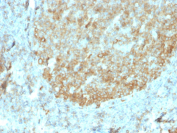 MALT1 Antibody Tonsil IHC. Immunohistochemistry analysis of Mucosa associated lymphoid tissue lymphoma translocation protein 1 / MALT1 expression in FFPE human tonsil tissue using recombinant mouse monoclonal antibody clone rMT1/410. This MALT1 Antibody shows cytoplasmic HRP-DAB brown staining in lymphoid cell populations, while surrounding stromal elements display reduced signal; nuclei are counterstained blue. Antigen retrieval was performed by boiling tissue sections in 10 mM Tris buffer with 1 mM EDTA, pH 9, for 10-20 min followed by cooling at room temperature.