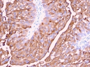 Immunohistochemistry of UPK1A antibody in human urinary bladder. Formalin-fixed, paraffin-embedded human urinary bladder tissue was stained with microarray validated Uroplakin 1A antibody (clone UPK1A/2921) following heat-induced epitope retrieval by boiling in pH 9 10 mM Tris with 1 mM EDTA for 10-20 minutes and cooling prior to testing. HRP-DAB brown chromogenic signal highlights strong membranous staining of urothelial umbrella cells along the luminal surface, consistent with the apical membrane localization and differentiation-associated expression pattern of Uroplakin 1A, while underlying stromal tissue shows minimal background staining.