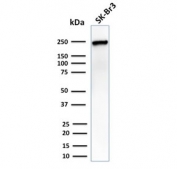 Western blot testing of human SK-BR-3 cells with CHD4 antibody. Predicted molecular weight ~218 kDa, commonly observed at 240-260 kDa.