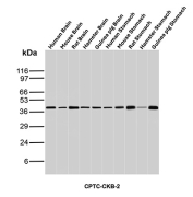 CKB Antibody for WB Multi-Species Clone CPTC-CKB-2. Western blot analysis of Human Brain, Mouse Brain, Rat Brain, Hamster Brain, Guinea pig Brain, Human Stomach, Mouse Stomach, Rat Stomach, Hamster Stomach and Guinea pig Stomach tissue lysates using Creatine kinase B antibody (clone CPTC-CKB-2). Predicted molecular weight ~43 kDa.