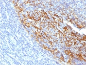 CD35 Antibody Tonsil IHC Clone To5. Immunohistochemistry staining of FFPE human tonsil with CD35 antibody (clone To5). HIER: boil tissue sections in pH 9 10mM Tris with 1mM EDTA for 10-20 min and allow to cool before testing.
