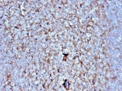 Cystatin A Antibody Tonsil Immunohistochemistry. IHC staining of FFPE human tonsil with Cystatin A antibody (clone CSTA/2882). HIER: boil tissue sections in pH 9 10mM Tris with 1mM EDTA for 10-20 min and allow to cool before testing.