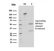 SDS-PAGE analysis of purified, BSA-free Cathepsin D antibody (clone CTSD/3083) as confirmation of integrity and purity.