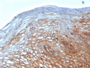Drebrin Neuronal Actin-Binding Protein Antibody Cervical Epithelium IHC. Immunohistochemistry analysis of FFPE human cervix using Drebrin Antibody (clone DBN1/2880) shows prominent cytoplasmic and membranous staining in stratified epithelial cells, consistent with DBN1 / Drebrin localization associated with actin cytoskeletal organization. The staining highlights epithelial cell layers with defined cell borders, reflecting actin-associated structural support within the tissue. Hematoxylin counterstain provides nuclear contrast and architectural detail. HIER: boil FFPE tissue sections in pH 9 10 mM Tris with 1 mM EDTA for 10-20 min followed by cooling at RT for 20 min.
