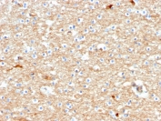 Drebrin Neuronal Actin-Binding Protein Antibody Brain Tissue IHC. Immunohistochemistry analysis of FFPE human brain tissue using Drebrin Antibody (clone DBN1/2880) shows diffuse cytoplasmic staining in neuronal cells with enrichment in neuronal processes, consistent with DBN1 / Drebrin localization associated with actin cytoskeletal organization in synaptic structures. The staining pattern highlights neuronal architecture, while surrounding non-neuronal regions display comparatively lower signal. Hematoxylin counterstain provides nuclear contrast and tissue context. HIER: boil FFPE tissue sections in pH 9 10 mM Tris with 1 mM EDTA for 10-20 min followed by cooling at RT for 20 min.