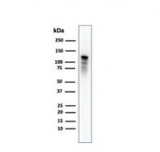 Drebrin Neuronal Actin-Binding Protein Antibody PC3 WB. Western blot analysis of human PC3 cell lysate using Drebrin Antibody (clone DBN1/2880) detects a band within the expected molecular weight range of approximately 70-120 kDa, consistent with DBN1 / Drebrin isoforms. The observed banding pattern reflects the presence of multiple Drebrin variants and potential post-translational modifications influencing electrophoretic mobility.