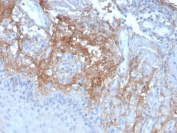 Decorin Antibody Human Skin Immunohistochemistry. IHC staining of FFPE human skin with Decorin antibody (clone DCN/3523). HIER: boil tissue sections in pH 9 10mM Tris with 1mM EDTA for 10-20 min and allow to cool before testing.